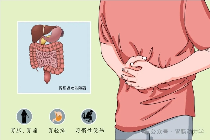 胃动力治疗仪