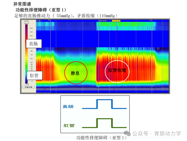 640_wx_fmt=png&from=appmsg&watermark=1&tp=webp&wxfrom=5&wx_lazy=1.png